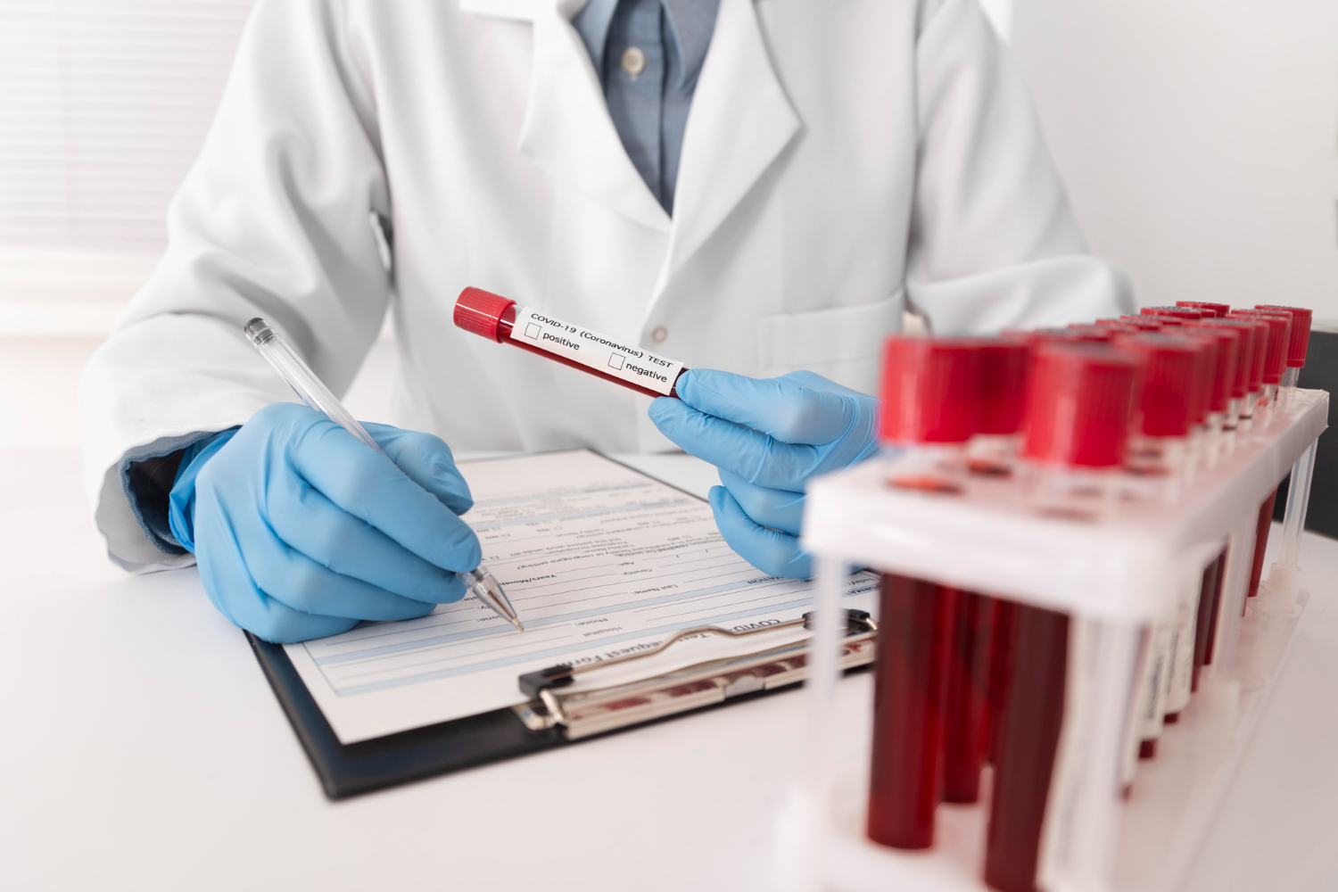 ¿Sabes qué datos nos aporta un análisis de sangre Global Med?